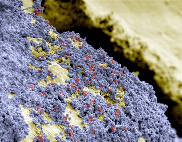 你看過這樣的嗎？顯微鏡下的口腔：這么恐怖